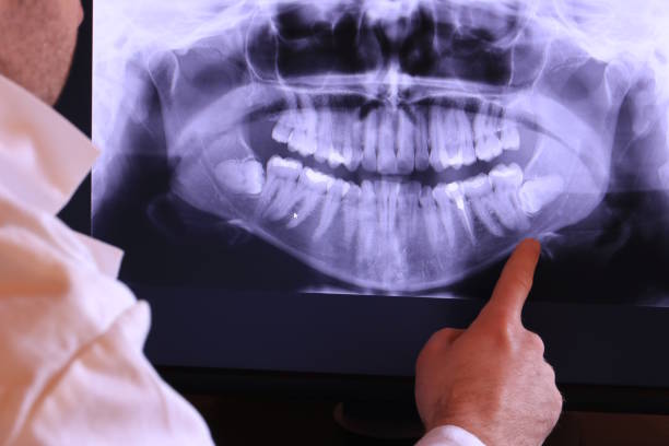 Best Emergency Treatment for Dental Infections or Abscesses in Unionville, TN