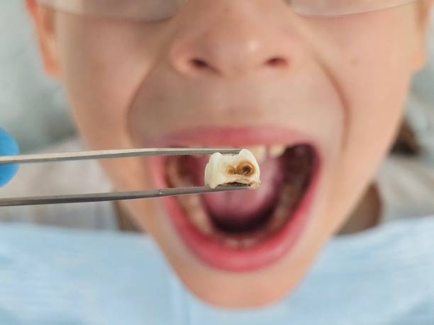 Best Same-Day Emergency Dental Services in Unionville, TN