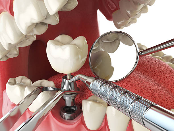 Best Emergency TMJ Treatment in Unionville, TN